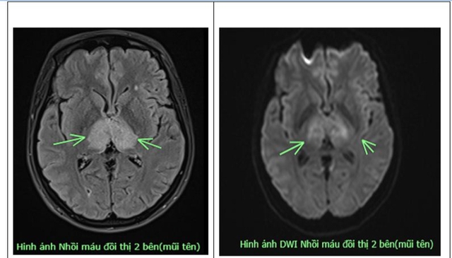 dau-dau-4-ngay-khong-do-nguoi-phu-nu-38-tuoi-mac-benh-nguy-hiem-o-nao