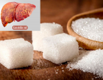 Sử dụng nhiều đường có thể gây ảnh hưởng nghiêm trọng tới sức khỏe của gan