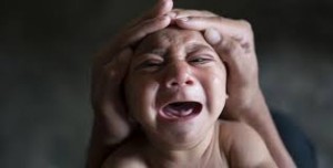 Bé 4 tháng tuổi ở Đắk Lắk nghi mắc chứng đầu nhỏ do Zika