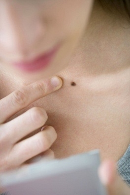 Nốt ruồi trên bầu ngực của phụ nữ tiết lộ điều gì?