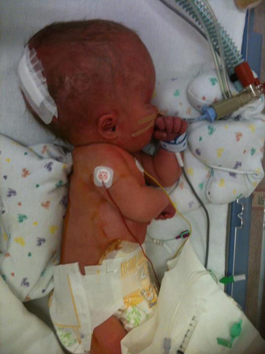 Bé trai sinh ra không có não, 4 năm sau khiến tất cả không tin vào mắt mình