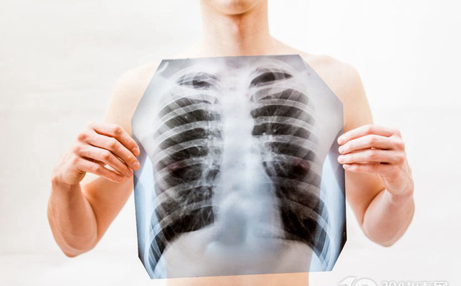 4 nhóm nghề nghiệp có nguy cơ mắc ung thư phổi cao nhất, hãy cảnh giác để phòng tránh sớm